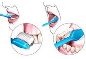 Best Dental Implants surgeon clinic in mylapore