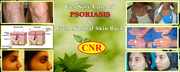 CNR HERBS | Treatment of Psoriasis | Cnr Herbs in Mumbai