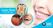 Dental Laser Treatment,  Laser Root Canal Treatment Cost In Chennai 