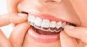 Teeth Straightening Aligners,  Clear Teeth Straighteners