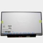 14 inch laptop screen replacement cost in chennai @3500