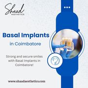 Basal Implants in Coimbatore | Shaadaesthetics