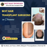 The Best Hair Transplant Clinic in Chennai