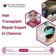 The Best Advanced Hair Transplant Clinic in Chennai