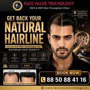 Get Back Your Natural Hairline with Advanced HDI Technology